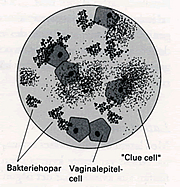 clue_cells3